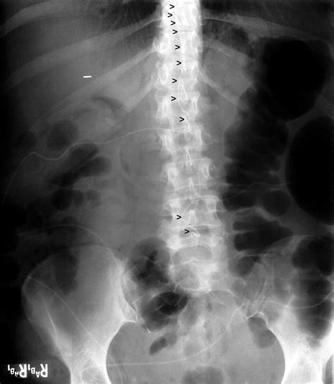 Medical Devices of the Neck and Spine: an imaging guide