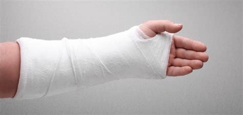 Plaster Casts in Patna | Fracture Treatment Plaster - Dr. Ashwini Gaurav