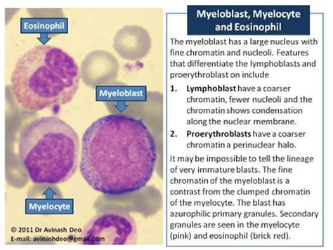 The earliest morphologically distinct myeloid cell is a myeloblast ...