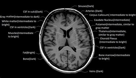 T1 vs T2 MRI | T1and T2 MRI image comparison