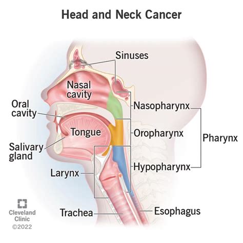 Head and Neck Cancers: Symptoms & Treatment