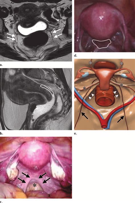 Normal anatomy of the female pelvis. (a, b) Axial (a) and sagittal (b ...