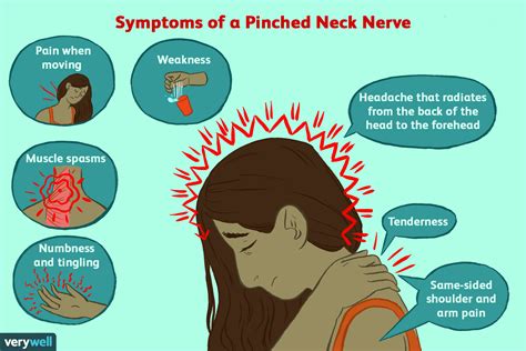 Pinched Nerve Numbness In Arm