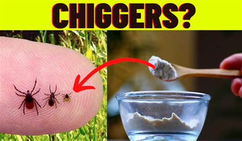 How to Easy Get Rid of Chiggers in Your Yard in 2022