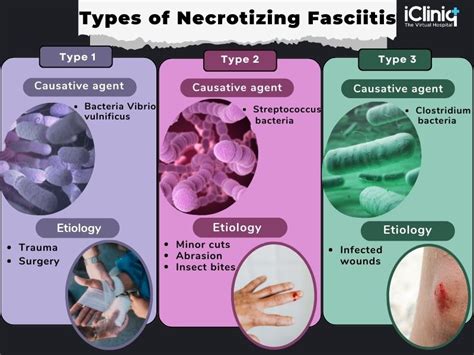 Necrotizing Fasciitis | Types | Risk | Symptoms | Diagnosis | Treatment