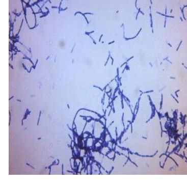 Bacillus Cereus Simple Stain