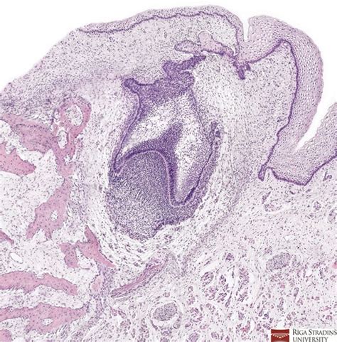 histology slides: Tooth, Tooth development-Karteikarten | Quizlet