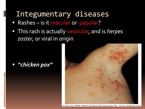 PPT - Selected Integumentary System Diseases & Conditions PowerPoint ...