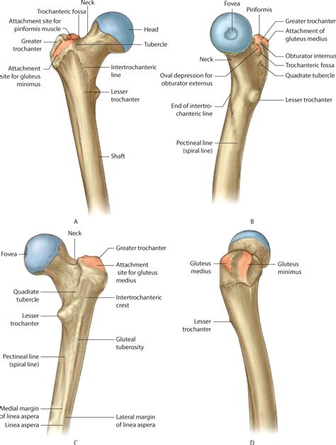 Extracapsular proximal femur fractures | Musculoskeletal Key