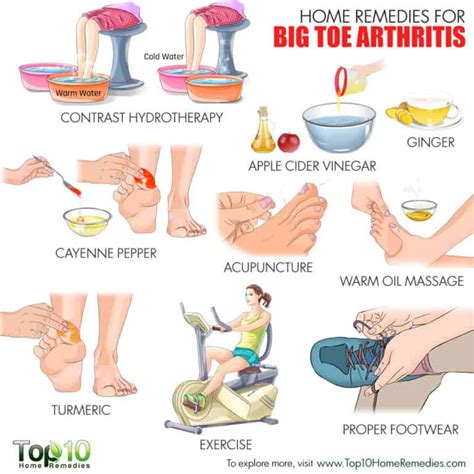 Home Remedies for Big Toe Arthritis | Top 10 Home Remedies