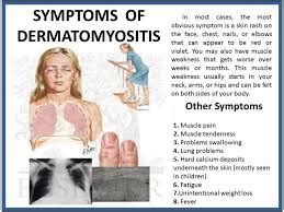 Dermatomyositis and Polymyositis Autoimmune Disorder