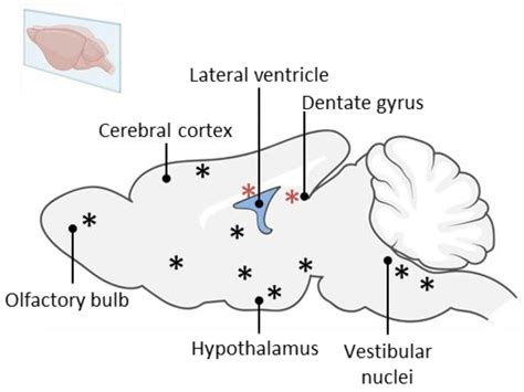 IJMS | Free Full-Text | The Vestibular Nuclei: A Cerebral Reservoir of ...