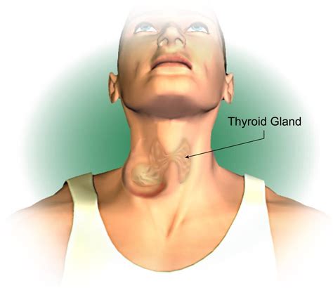 Thyroid Cancer: Types, Symptoms, Diagnosis, Treatment - PMCC Denver ...