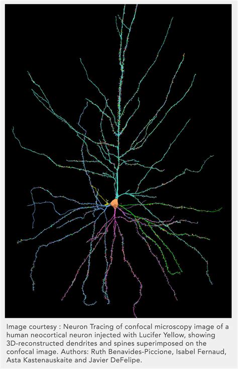 Neuron Tracing and Reconstruction – MBF Bioscience