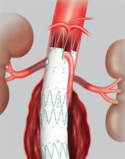 Department of Surgery News | Stony Brook University School of Medicine