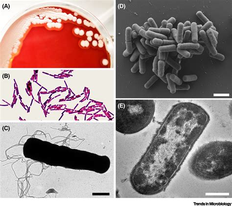 Bacillus cereus: Epidemiology, Virulence Factors, and Host–Pathogen ...