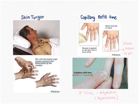 Dehydrated Skin Test