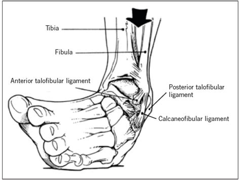 The Weekend Athlete: Common Foot and Ankle Injuries | Consultant360