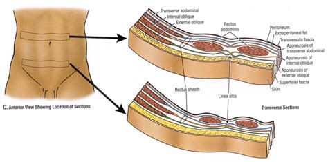 ARCUATE LINE Diagram | Quizlet