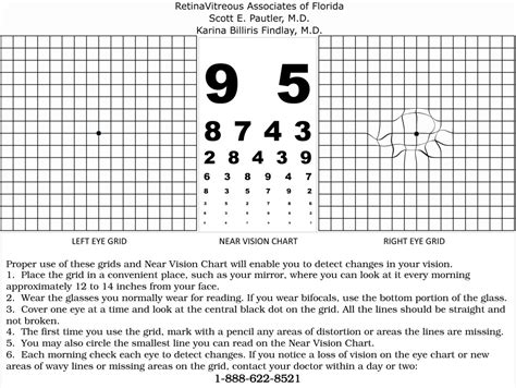 Amsler Grid Chart Printable