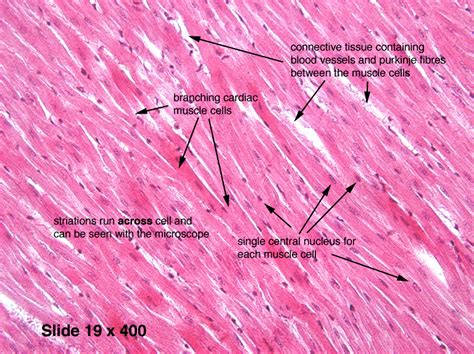 Pin on Histology - Muscle