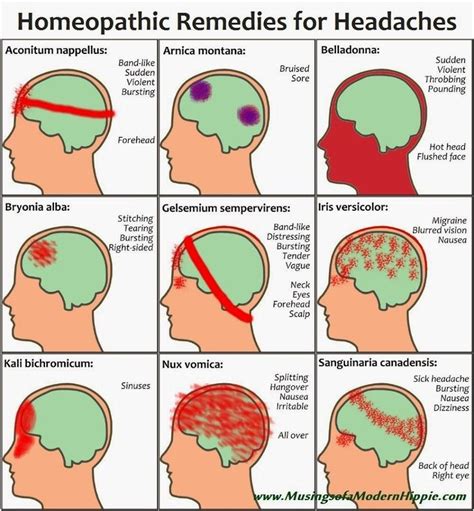 17 Best images about acupuncture-for-headache on Pinterest | Chronic ...