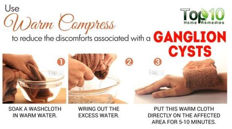 Home Remedies for Ganglion Cysts | Top 10 Home Remedies