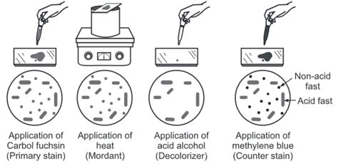 Acid Fast Staining: Principle, Procedure and Examples - Biology Ease