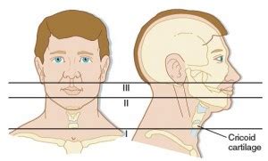 emDOCs.net – Emergency Medicine EducationNeck Trauma: A Practice Update ...