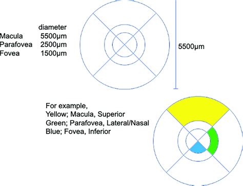 Modified ETDRS grid. (A) Each area of the modified ETDRS grid was ...