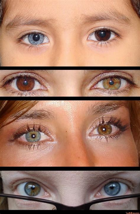 http://www.junglekey.fr/wiki/definition.php?terme=Heterochromia ...