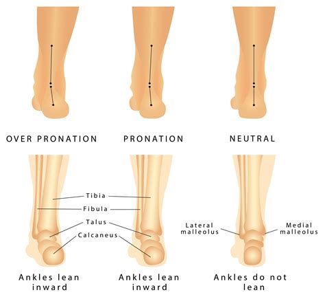 Tips For Selecting the Best Orthotics for Your Flat Feet