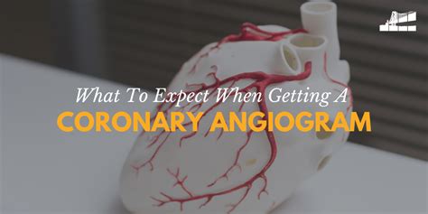 What To Expect When Getting A Coronary Angiogram — Bay Imaging Consultants