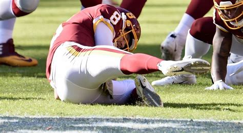 Joe Theismann Injury Picture