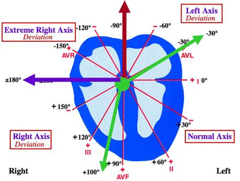 Ekg Axis