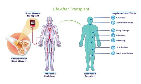 Bone Marrow Transplant in Delhi/NCR, Bone Marrow Transplant in Delhi