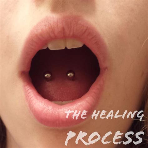 The Healing Process of a Tongue Piercing (With Pictures) - TatRing