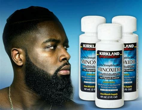 What are the Side Effects of Using Minoxidil on Your Beard?