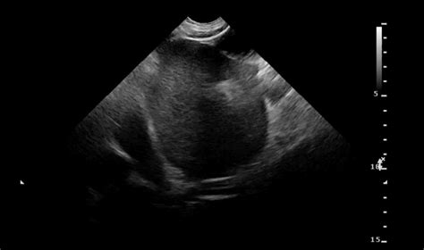 gastric ultrasound Archives - eMedical Academy