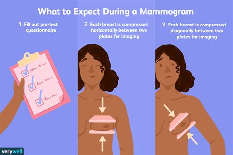 Clinical Breast Exam Technique