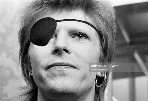 David Bowie, wearing an eye patch, conducts a press conference at the ...