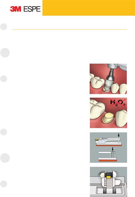 RelyX Unicem Technique Guide Cementation Down