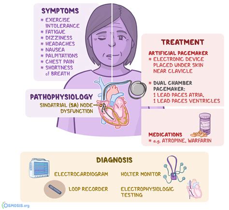 Sick Sinus Syndrome Causes Symptoms Ecg Treatment | Hot Sex Picture