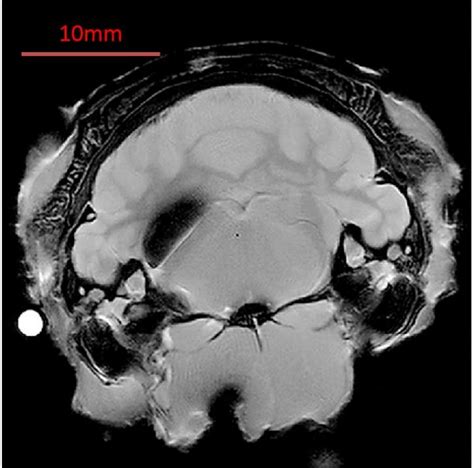 Rat brain atlas provides MR images for stereotaxic surgery - Medical ...