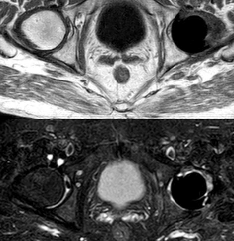 Hip MRI scan | Medserena Open MRI