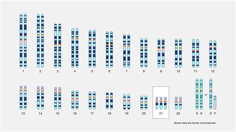 Cri Du Chat Syndrome Chromosome