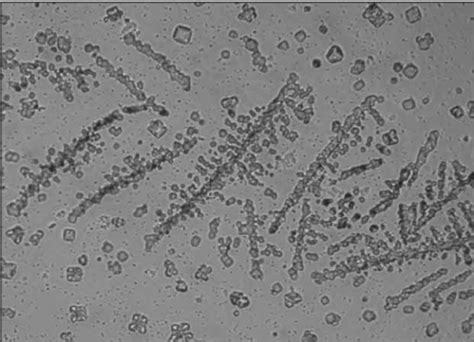 Type S mucus crystallization of a heifer at oestrus observed under ...