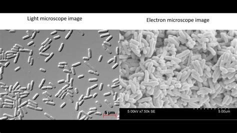 What do bacteria look like under a light vs electron microscope? - YouTube