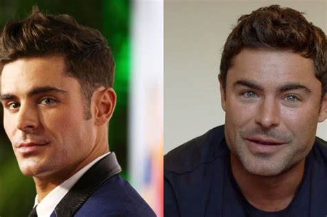 ‘Jaw gate’– Zac Efron denies he’s done plastic surgery | Graaff-Reinet ...