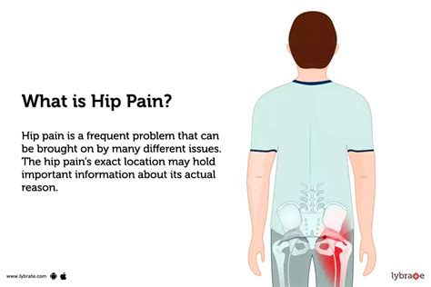 Hip Pain: Treatment, Procedure, Cost, Recovery, Side Effects And More